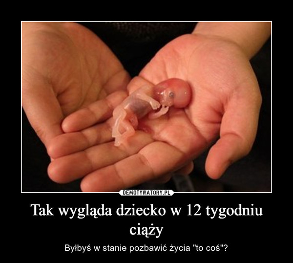 Tak wygląda dziecko w 12 tygodniu ciąży – Demotywatory.pl
